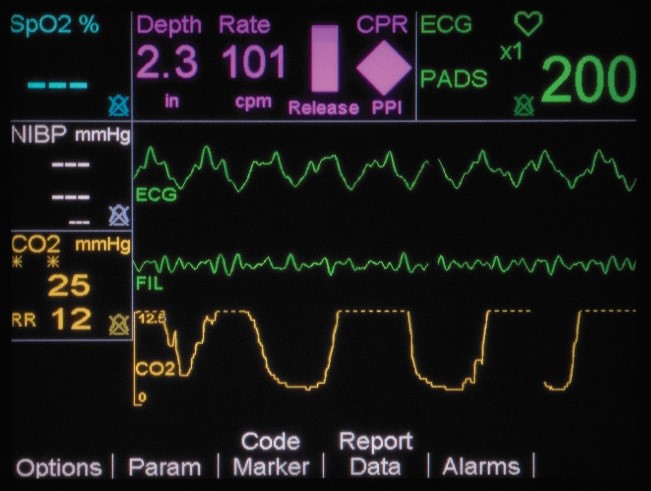 CPR Sensor Real CPR_HelpTimeline